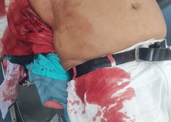 सिवान में अंधाधुंध फायरिंग, पूर्व जिला पार्षद के भाई को गोलियों से भूना –