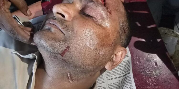 बड़हरिया के महावीरी मेला में दो समुदायों में हुआ पथराव, एसपी ने संभाला मोर्चा बड़हरिया थानाध्यक्ष रूपेश कुमार वर्मा पथराव में हुए घायल