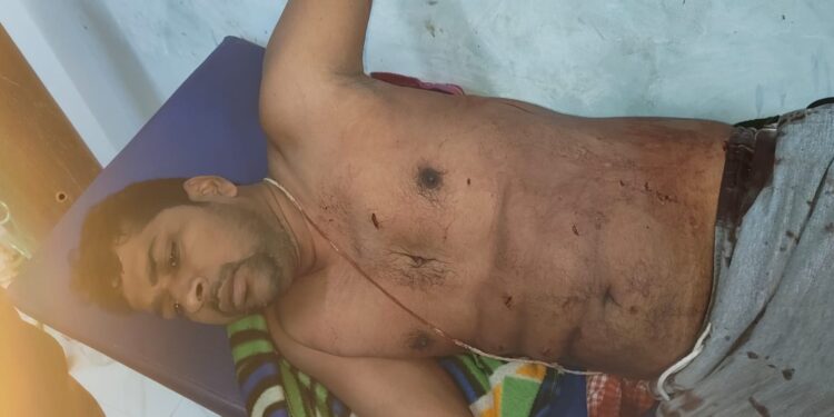 कूड़ा फेंकने के विवाद में खूनी संघर्ष, चाकूबाजी में पिता-पुत्र जख्मी, गोरखपुर रेफर